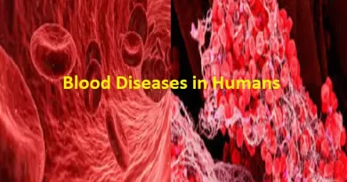 Blood Diseases